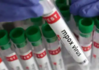 美国加州确诊猴痘新变异毒株感染 猴痘事件始末2024最新消息