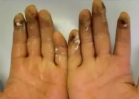 8岁小学生沉迷拍烟卡手指溃烂 画面曝光简直不忍直视