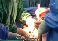 中国已分别成功将猪肾和肝移植进人体 实在太让人期待了