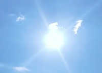 7旬大爷晒太阳后感染细菌险丧命 可怕至极真相简直太吓人了