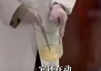 女子体内排出10米长寄生虫 可怕至极真相简直太吓人了