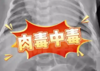 52天婴儿喝奶奶喂的蜂蜜水中毒进ICU 为什么中毒什么原因？