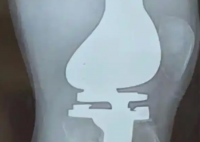 15岁少年休学抗癌三年后离世 事件始末2025最新消息