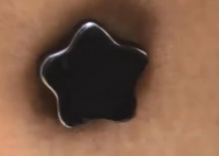 男子脸肿4天后意外吸住磁铁 究竟是怎么回事？