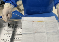 13岁男孩将55厘米数据线插进尿道 到底是什么情况？