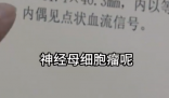 女孩因个矮去体检发现肾上长肿瘤 到底是什么情况？