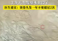 男子一月染头4次致头发大量脱落 背后真相实在让人惊愕
