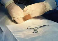 西南首例戒酒芯片植入术成功实施 究竟是怎么回事？