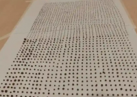 64岁大爷体内取出1791颗结石 内幕实在让人惊个呆