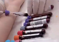 医生:胖人比瘦人更能抗病 究竟是怎么回事？