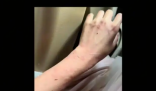 女演员贵州拍戏遇极端天气 胳膊受伤 为什么引热议？