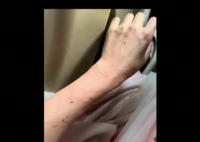 女演员贵州拍戏遇极端天气 胳膊受伤 为什么引热议？