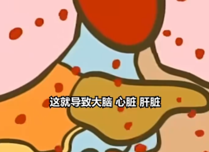 医生:患热射病时内脏像被开水煮 究竟是怎么回事？