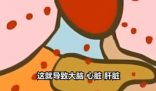 医生:患热射病时内脏像被开水煮 究竟是怎么回事？