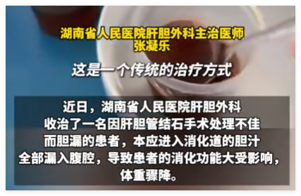 男子每天喝500ml自己的胆汁救命 内幕实在让人惊个呆