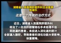 男子每天喝500ml自己的胆汁救命 内幕实在让人惊个呆
