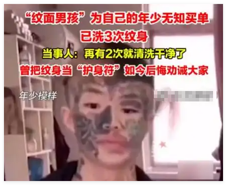 “纹面男孩”称再洗2次纹身就干净了 画面曝光简直太崩溃了
